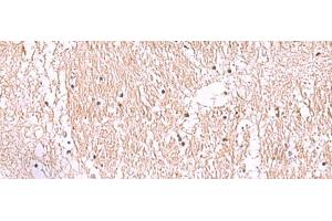 Immunohistochemistry of paraffin-embedded Human brain tissue using RIC8A Polyclonal Antibody at dilution of 1:55(x200) (RIC8A 抗体)
