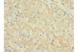 Immunohistochemistry of paraffin-embedded human liver tissue using ABIN7174246 at dilution of 1:100 (COQ4 抗体  (AA 31-265))