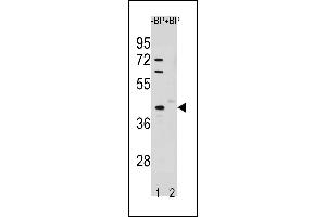 Western blot analysis of STK25 Antibody (C-term) Pab (ABIN1881851 and ABIN2843256) pre-incubated without(lane 1) and with(lane 2) blocking peptide in A549 cell line lysate. (STK25 抗体  (C-Term))
