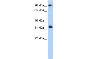 WB Suggested Anti-CCDC69 Antibody Titration: 0. (CCDC69 抗体  (Middle Region))