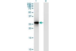 Western Blot analysis of RPP30 expression in transfected 293T cell line by RPP30 polyclonal antibody (A01). (RPP30 抗体  (AA 169-268))