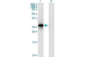 Western Blot analysis of RPP30 expression in transfected 293T cell line by RPP30 polyclonal antibody (A01). (RPP30 抗体  (AA 169-268))