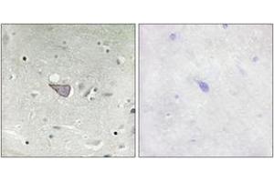 Immunohistochemistry analysis of paraffin-embedded human brain tissue, using ARMX3 Antibody. (ARMCX3 抗体  (AA 291-340))