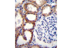 Immunohistochemistry (Paraffin-embedded Sections) (IHC (p)) image for anti-Succinate Dehydrogenase Complex, Subunit D, Integral Membrane Protein (SDHD) (AA 13-42), (N-Term) antibody (ABIN656089)
