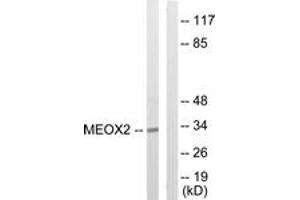 Western blot analysis of extracts from COLO205 cells, using MEOX2 Antibody. (MEOX2 抗体  (AA 151-200))