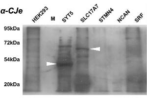 Western blot analysis of the cross-reactivity of antibodies directed against Campylobacter jejuni with different protein samples as provided by commercial HEK-293 overexpression lysates. (Campylobacter jejuni 抗体)