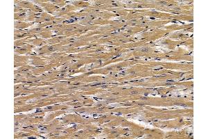 ABIN7095188 and ABIN7099244 at 1/100 staining rat heart tissue by IHC-P.