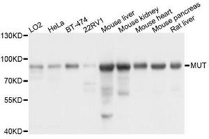 Western blot analysis of extracts of various cell lines, using MUT antibody. (MUT 抗体  (AA 451-750))