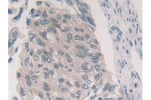 Immunohistochemistry (IHC) image for anti-Proteasome (Prosome, Macropain) Subunit, beta Type, 6 (PSMB6) (AA 2-239) antibody (ABIN7436234)