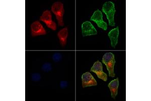 ABIN6263378 and ABIN6279009 staining HepG2 cells by IF/ICC.