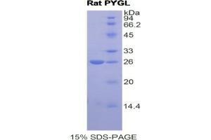 SDS-PAGE analysis of Rat PYGL Protein. (PYGL 蛋白)