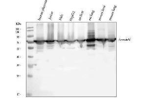 Western blot analysis of Annexin VI/ANXA6 using anti-Annexin VI/ANXA6 antibody (ABIN5692982).