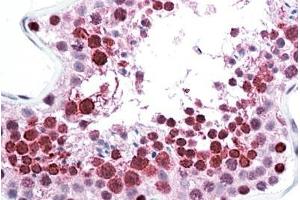 ABIN768540 (5µg/ml) staining of paraffin embedded Human Testis. (C22orf28 抗体  (AA 201-215))