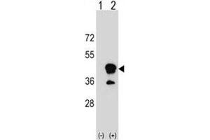 Western blot analysis of CD1b antibody and 293 cell lysate (2 ug/lane) either nontransfected (Lane 1) or transiently transfected (2) with the CD1B gene. (CD1b 抗体  (AA 57-85))