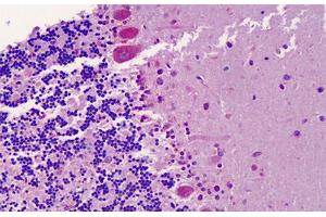 Human Brain, Cerebellum: Formalin-Fixed, Paraffin-Embedded (FFPE) (CXCR7 抗体  (AA 311-360))