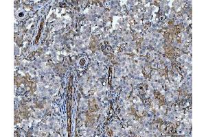 IHC analysis of STBD1 using anti-STBD1 antibody (ABIN7601576).