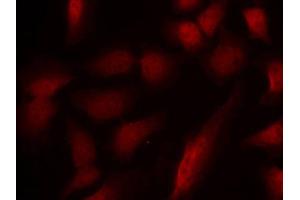 Immunofluorescence staining of methanol-fixed HeLa cells using Phospho-GATA1-S310 antibody (ABIN2988025). (GATA1 抗体  (pSer310))