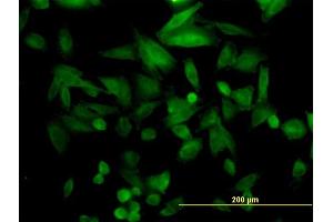 Immunofluorescence of monoclonal antibody to FHL5 on HepG2 cell. (FHL5 抗体  (AA 1-284))