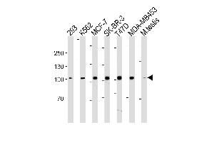 Lane 1: 293 Cell lysates, Lane 2: K562 Cell lysates, Lane 3: MCF-7 Cell lysates, Lane 4: SK-BR-3 Cell lysates, Lane 5: T47D Cell lysates, Lane 6: MDA-MB-453 Cell lysates, Lane 7: mouse testis lysates, probed with ACE2 (881CT16. (ACE2 抗体)