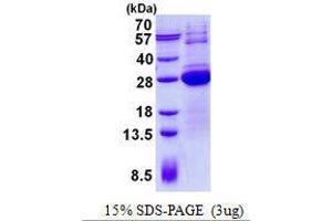 Figure annotation denotes ug of protein loaded and % gel used. (LSM12B 蛋白)
