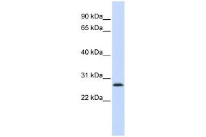 WB Suggested Anti-LSM12 Antibody Titration: 0. (LSM12B 抗体  (Middle Region))