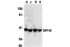 Western Blotting (WB) image for anti-DNA Fragmentation Factor, 45kDa, alpha Polypeptide (DFFA) (C-Term) antibody (ABIN1030360) (DFFA 抗体  (C-Term))