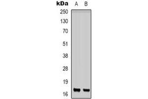Western blot analysis of CD225 expression in K562 (A), PC12 (B) whole cell lysates. (IFITM1 抗体  (N-Term))