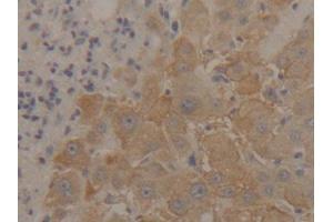 Immunohistochemistry (IHC) image for anti-Enolase 1 (ENO1) (AA 1-434) antibody (ABIN1077991)