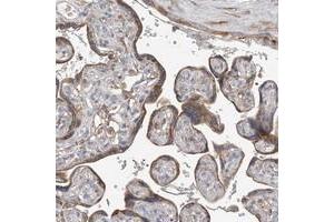 Immunohistochemical staining of human placenta with GALNTL6 polyclonal antibody  shows moderate cytoplasmic positivity in trophoblastic cells.