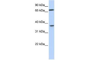 WB Suggested Anti-MAP2K3 Antibody Titration:  0. (MAP2K3 抗体  (C-Term))