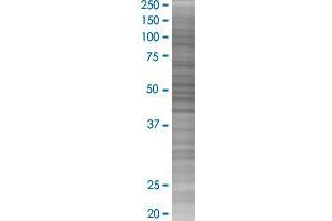 NAP1L1 transfected lysate. (NAP1L1 293T Cell Transient Overexpression Lysate(Denatured))