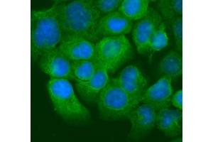 IF analysis of Krt20 using anti-Krt20 antibody (ABIN7601133). (KRT20 抗体  (AA 29-431))