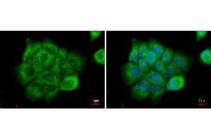 ICC/IF Image NPR-C antibody [N3C3] detects NPR-C protein at cytoplasm by immunofluorescent analysis. (NPR3 抗体)