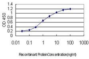 Detection limit for recombinant GST tagged CHD4 is approximately 0. (CHD4 抗体  (AA 1632-1730))