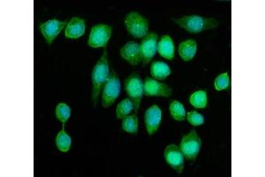 IF analysis of KIF2A using anti-KIF2A antibody (ABIN7600510). (KIF2A 抗体  (AA 2-706))