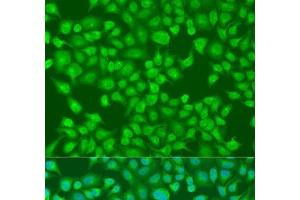 Immunofluorescence analysis of U2OS cells using ACOX1 Polyclonal Antibody at dilution of 1:100. (ACOX1 抗体)