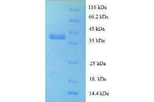 SDS-PAGE (SDS) image for Ribosomal Protein L28 (RPL28) (AA 2-137) protein (GST tag) (ABIN5710274)