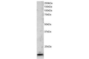 Image no. 1 for anti-Telomeric Repeat Binding Factor 2 (TERF2) (C-Term) antibody (ABIN374265) (TRF2 抗体  (C-Term))