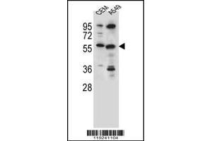 Western blot analysis in CEM,A549 cell line lysates (35ug/lane). (CSAD 抗体  (AA 197-226))
