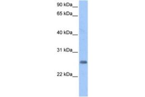 Western Blotting (WB) image for anti-Zinc Finger Protein Pseudogene (LOC728743) antibody (ABIN2463386) (LOC728743 抗体)