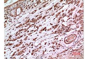 Immunohistochemistry (IHC) analysis of paraffin-embedded Human Brain, antibody was diluted at 1:100. (p53 抗体  (Tyr216))