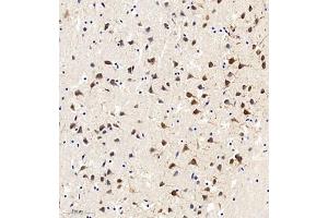 Immunohistochemistry of paraffin embedded mouse brain using MAP9 (ABIN7074622) at dilution of 1:750 (300x lens) (MAP9 抗体)