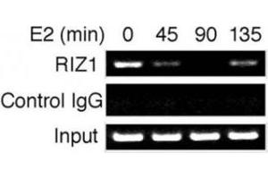 Time course analysis of RIZ1 binding to the pS2 gene promoter. (PRDM2 抗体  (AA 1-347))