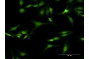 Immunofluorescence of purified MaxPab antibody to SEPT5 on HeLa cell. (Septin 5 抗体  (AA 1-369))