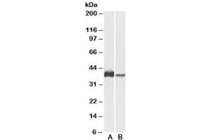 Western blot testing of U937 [A] and human spleen [B] lysates with CAPG antibody at 0. (CAPG 抗体)