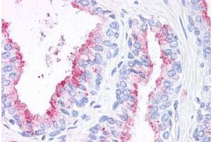 Immunohistochemistry (IHC) image for anti-Wingless-Type MMTV Integration Site Family, Member 5B (WNT5B) (Internal Region) antibody (ABIN1049479)
