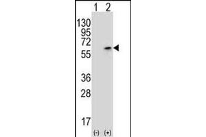 Western blot analysis of PCTK3 (arrow) using rabbit polyclonal PCTK3 Antibody (N40) (ABIN391790 and ABIN2841646). (CDK18 抗体  (N-Term))