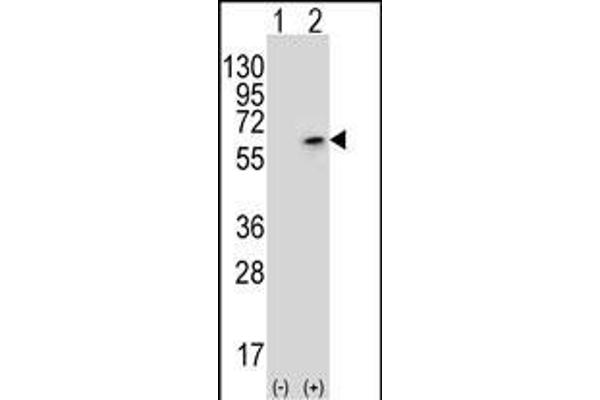 CDK18 抗体  (N-Term)