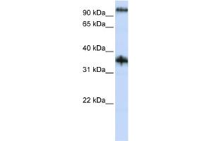 WB Suggested Anti-C9orf4 Antibody Titration:  0. (Ferric-Chelate Reductase 1 Like (FRRS1L) (N-Term) 抗体)