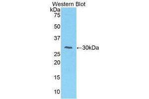 Western Blotting (WB) image for anti-Interleukin-1 Receptor-Associated Kinase 2 (IRAK2) (AA 211-458) antibody (ABIN3206500) (IRAK2 抗体  (AA 211-458))